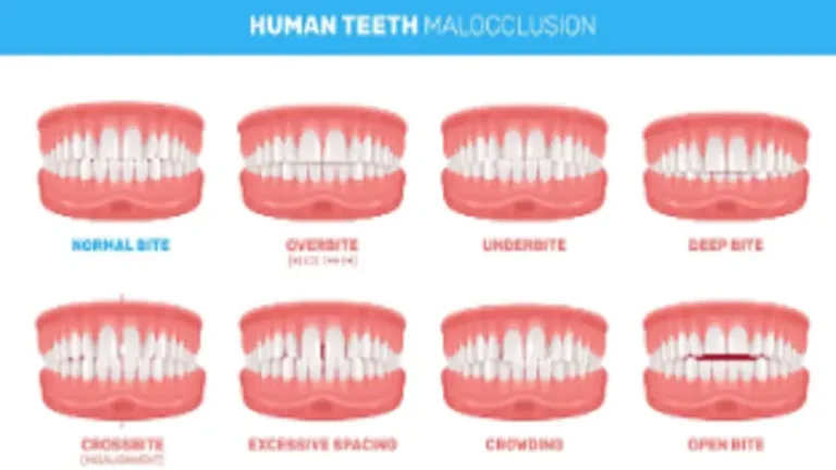 aligned teeth